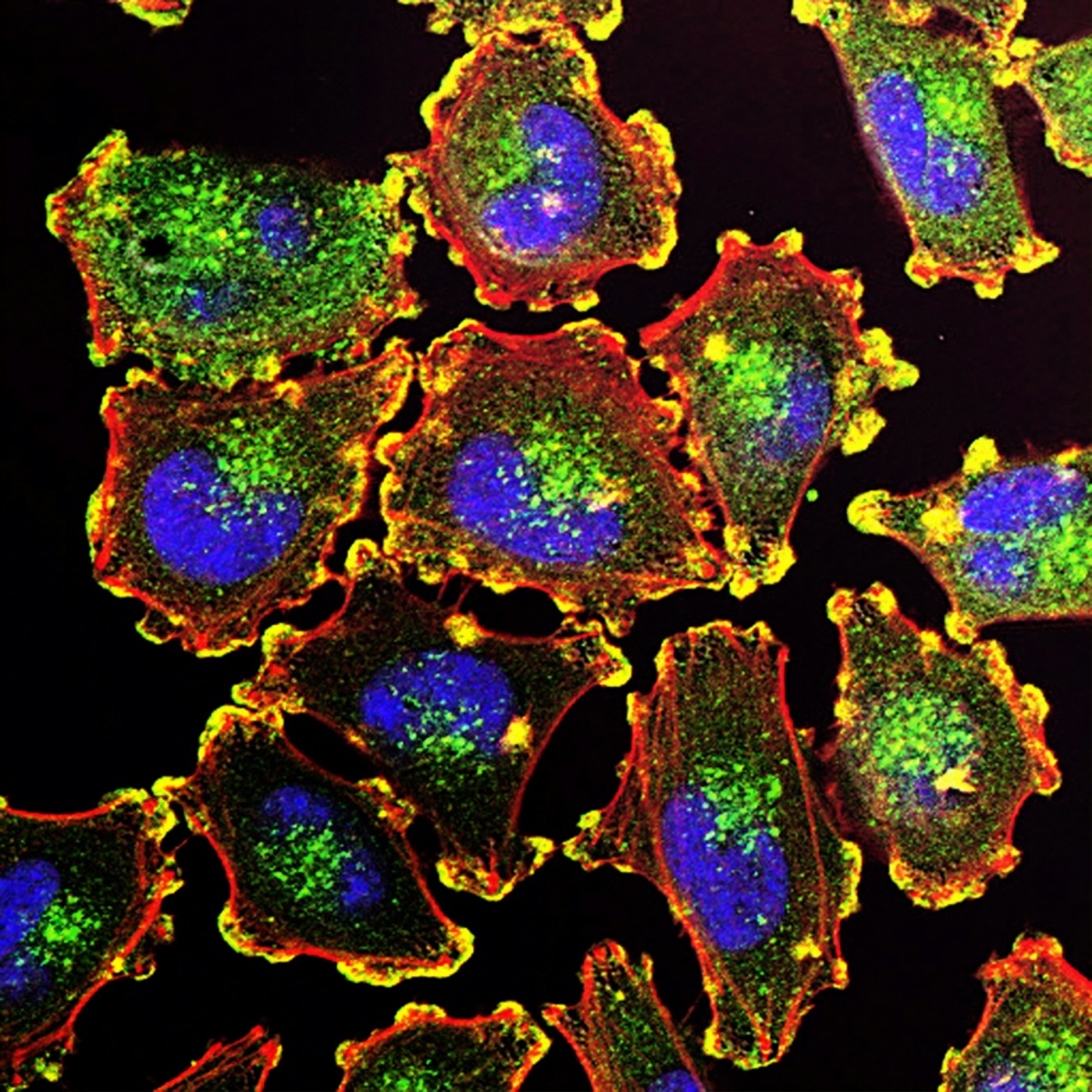 Rephrase the title:Unlocking Insights: Prion-Like Proteins in COVID-19, mRNA Vaccines—Prion Diseases Could Emerge