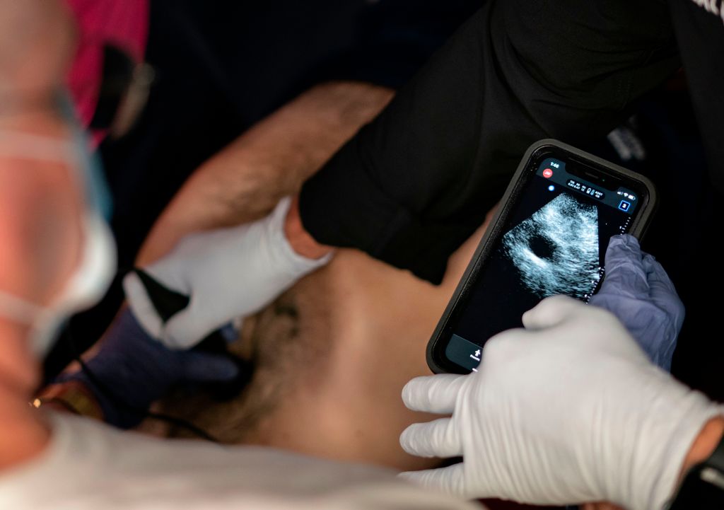 AI Learns to Spot COVID-19 in Lung Ultrasound Images